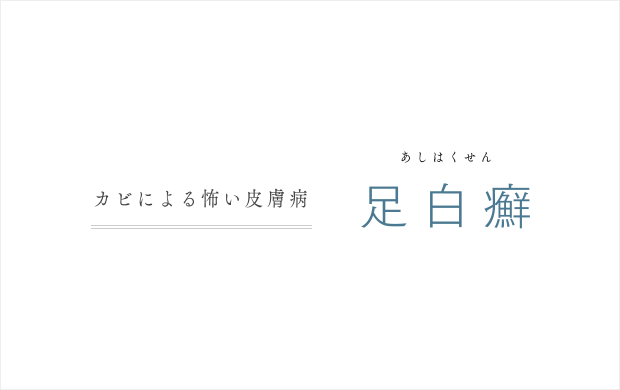 足白癬